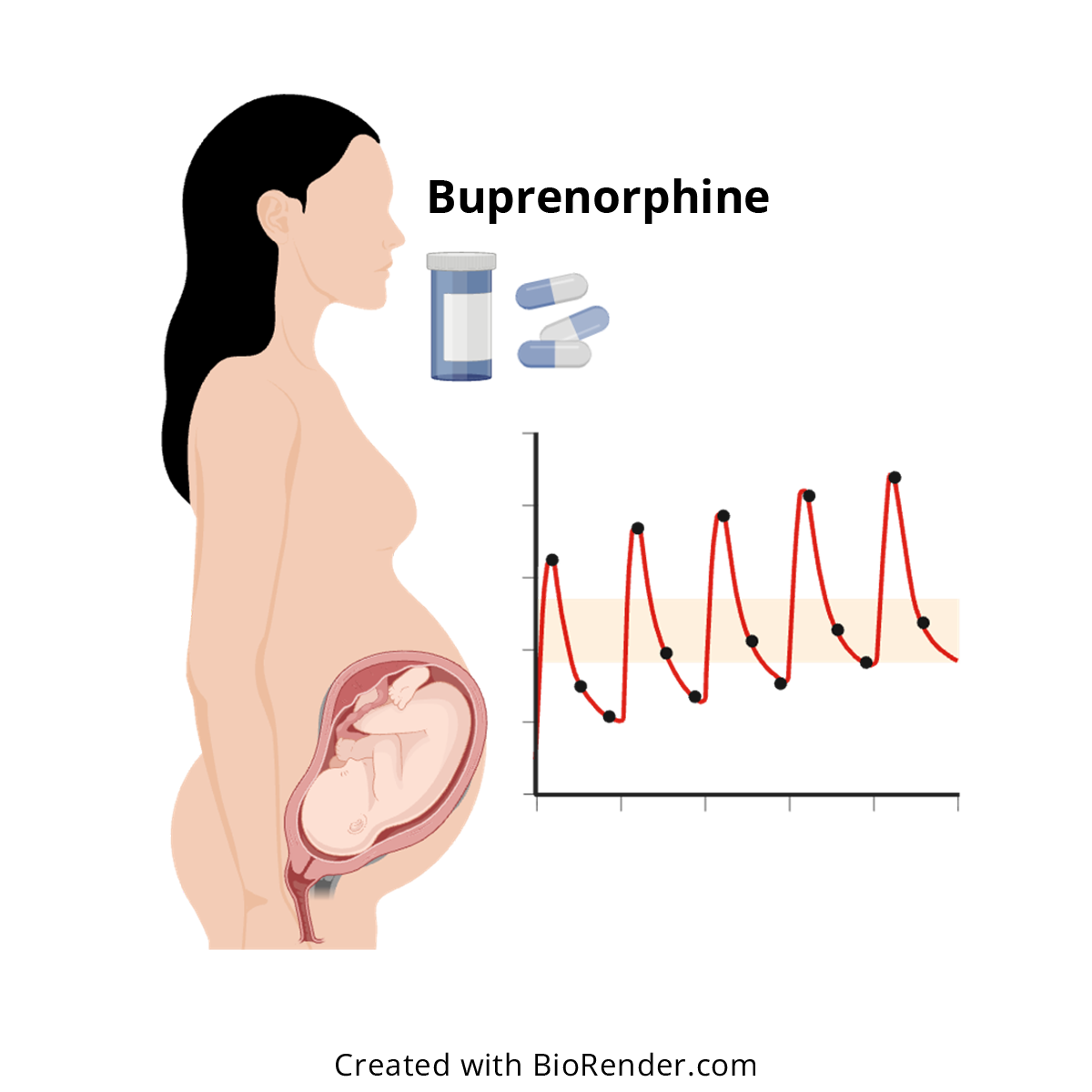 Optimizing buprenorphine dosing in pregnancy. 